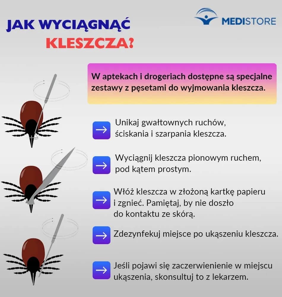 Jak bezpiecznie wyjąć kleszcza kotu i uniknąć groźnych konsekwencji